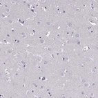 Immunohistochemical staining of human cerebral cortex shows no positivity in neurons as expected.