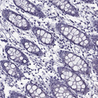 Immunohistochemical staining of human colon shows no positivity in glandular cells as expected.
