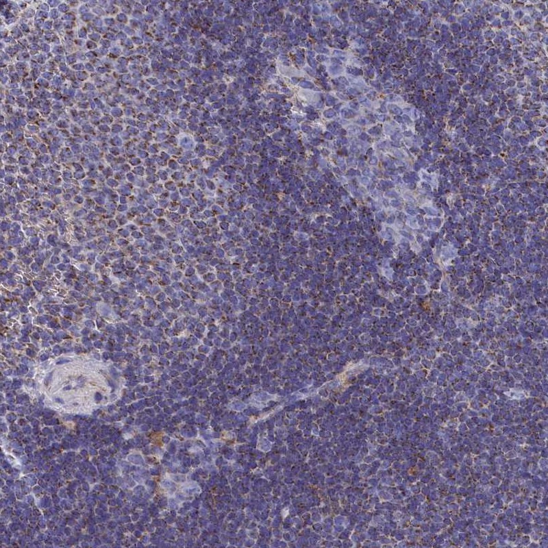 Anti-CCRL2 Antibody
