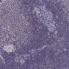 Anti-CCRL2 Antibody