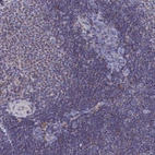 Anti-CCRL2 Antibody