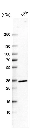 Western blot analysis in human cell line HEL.