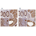 Anti-ST13 Antibody