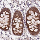 Immunohistochemical staining of human colon using Anti-ST13 antibody HPA043233.