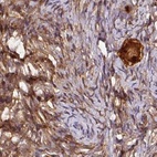Immunohistochemical staining of human ovary using Anti-ST13 antibody HPA043233.