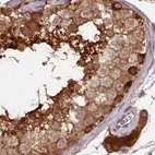 Immunohistochemical staining of human testis using Anti-ST13 antibody HPA043233.
