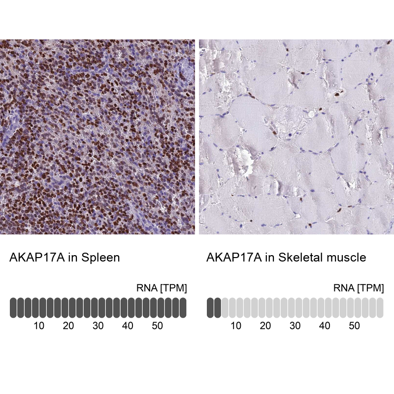 Anti-AKAP17A Antibody