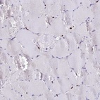 Immunohistochemical staining of human skeletal muscle shows low expression as expected.