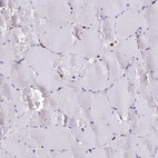 Anti-AKAP17A Antibody