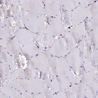 Immunohistochemical staining of human skeletal muscle shows low expression as expected.