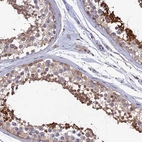 Anti-KIAA1211 Antibody