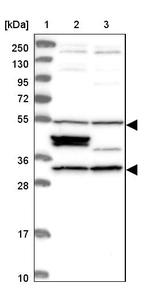 Lane 1: Marker [kDa] 250, 130, 95, 72, 55, 36, 28, 17, 10_br/_Lane 2: Human cell line RT-4_br/_Lane 3: Human cell line U-251MG sp