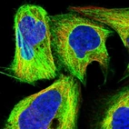 Immunofluorescent staining of human cell line U-2 OS shows localization to cytosol, actin filaments & intermediate filaments.