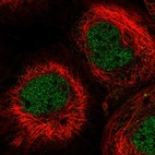 Immunofluorescent staining of human cell line A-431 shows localization to nucleoplasm.
