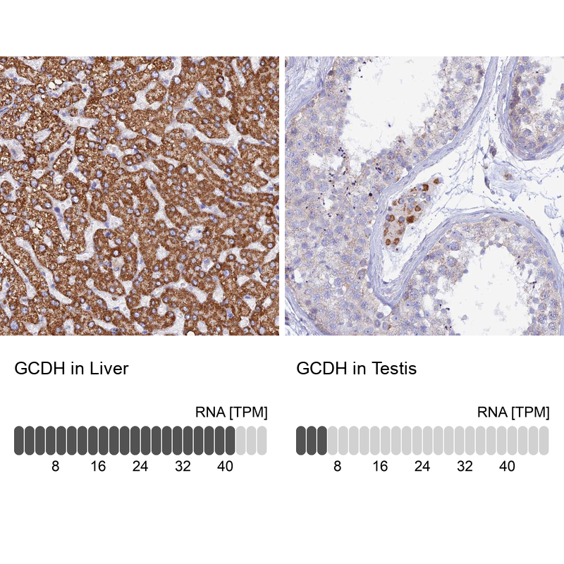 Anti-GCDH Antibody