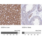 Anti-GCDH Antibody