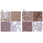 Immunohistochemical staining of human kidney, liver, pancreas and testis using Anti-GCDH antibody HPA043252 (A) shows similar protein distribution across tissues to independent antibody HPA048492 (B).