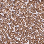 Immunohistochemical staining of human liver shows strong granular cytoplasmic positivity in hepatocytes.
