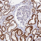 Immunohistochemical staining of human kidney shows strong granular cytoplasmic positivity in cells in tubules.
