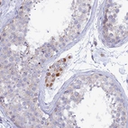 Immunohistochemical staining of human testis shows moderate granular cytoplasmic positivity in Leydig cells.