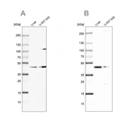 Western blot analysis using Anti-GCDH antibody HPA043252 (A) shows similar pattern to independent antibody HPA048492 (B).