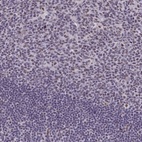 Anti-RBM12 Antibody