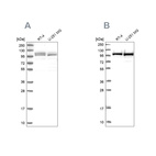 Western blot analysis using Anti-RBM12 antibody HPA043258 (A) shows similar pattern to independent antibody HPA043621 (B).