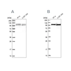 Western blot analysis using Anti-RBM12 antibody HPA043258 (A) shows similar pattern to independent antibody HPA043621 (B).