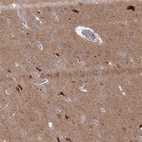 Immunohistochemical staining of human cerebral cortex shows high expression.