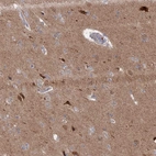 Immunohistochemical staining of human cerebral cortex shows high expression.