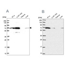 Western blot analysis using Anti-IRGQ antibody HPA043254 (A) shows similar pattern to independent antibody HPA050338 (B).