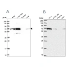 Western blot analysis using Anti-IRGQ antibody HPA043254 (A) shows similar pattern to independent antibody HPA050338 (B).