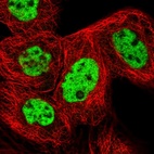 Immunofluorescent staining of human cell line A-431 shows localization to nucleoplasm.