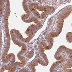 Immunohistochemical staining of human fallopian tube shows high expression.