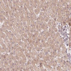 Immunohistochemical staining of human liver shows low expression as expected.