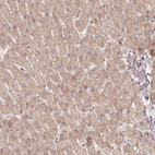 Immunohistochemical staining of human liver shows low expression as expected.