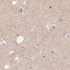 Immunohistochemical staining of human cerebral cortex using Anti-WDR54 antibody HPA043257.