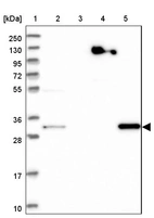 Lane 1: Marker [kDa] 250, 130, 95, 72, 55, 36, 28, 17, 10_br/_Lane 2: Human cell line RT-4_br/_Lane 3: Human cell line U-251MG sp_br/_Lane 4: Human plasma (IgG/HSA depleted)_br/_Lane 5: Human liver tissue