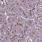 Anti-POTEE Antibody