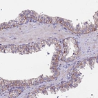 Immunohistochemical staining of human prostate shows moderate membranous positivity in glandular cells.