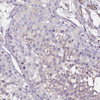 Immunohistochemical staining of human Testis shows weak cytoplasmic positivity in cells in seminiferous ducts.