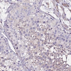 Immunohistochemical staining of human Testis shows weak cytoplasmic positivity in cells in seminiferous ducts.