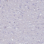 Immunohistochemical staining of human Cerebral cortex shows no positivity in neuronal cells as expected.