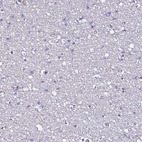 Immunohistochemical staining of human Cerebral cortex shows no positivity in neuronal cells as expected.