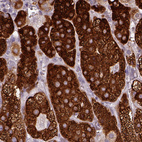 Anti-HSD3B1 Antibody