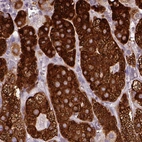 Anti-HSD3B1 Antibody