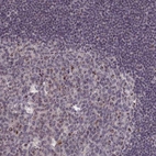 Anti-PPAN Antibody