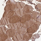 Immunohistochemical staining of human skeletal muscle shows moderate cytoplasmic positivity in myocytes.