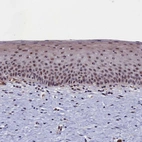 Immunohistochemical staining of human cervix shows strong positivity in nucleoli in squamous epithelial cells.