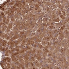 Immunohistochemical staining of human liver shows moderate cytoplasmic positivity in hepatocytes.